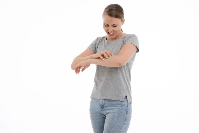 Woman scratching arm