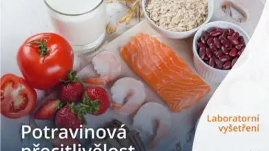 Různé potraviny jako ryba, ovoce a obiloviny pro test potravinové citlivosti.