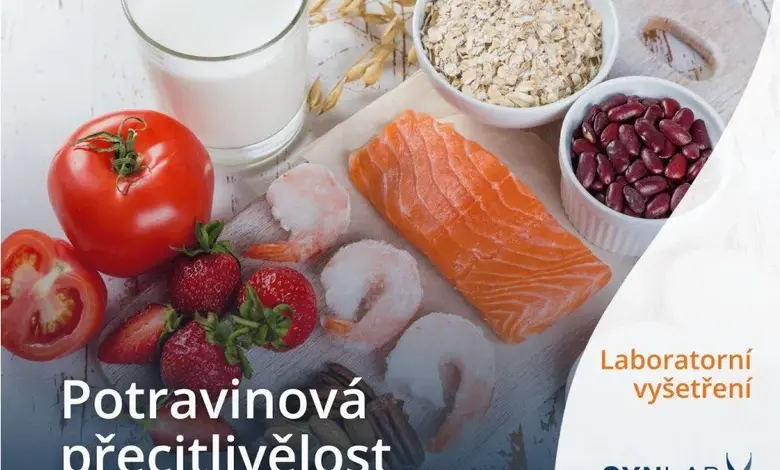 Různé potraviny jako ryba, ovoce a obiloviny pro test potravinové citlivosti.