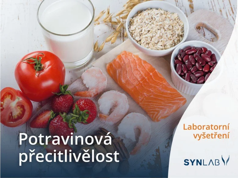 Různé potraviny jako ryba, ovoce a obiloviny pro test potravinové citlivosti.