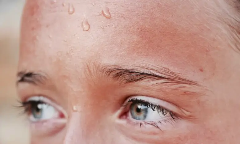 Dítě s potem na čele při úpalu