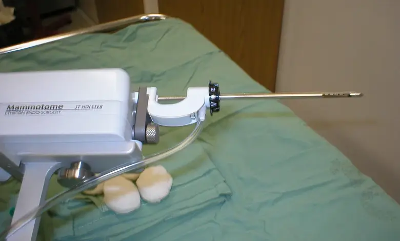 Biopsie pod ultrazvukem pomocí přístroje Mammotome na sterilním plátně