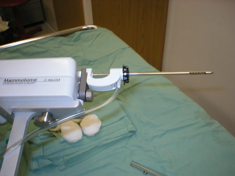 Biopsie pod ultrazvukem pomocí přístroje Mammotome na sterilním plátně