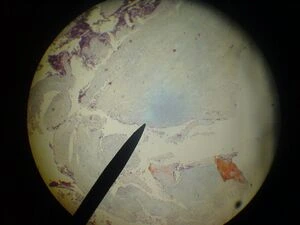 Mikroskopický snímek tkáně hyalinní chrupavky s typickým vzhledem pro histologii.